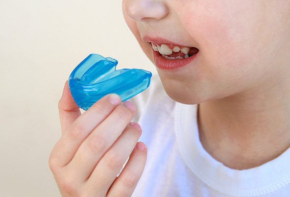 お口の癖と歯並びからアプローチする矯正装置 イメージ2