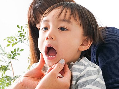 お口の癖と歯並びからアプローチする矯正装置 イメージ1