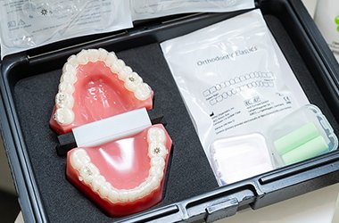 マウスピース矯正（インビザライン） イメージ